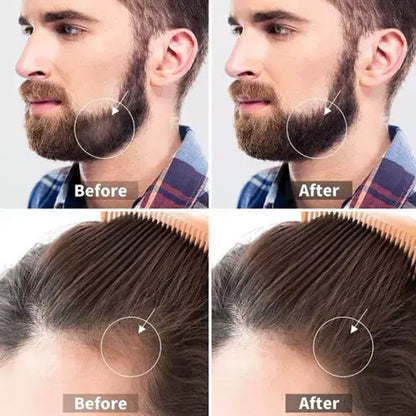AM7189 Derma Roller For Hair Growth